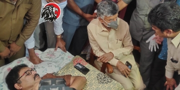 TDP’s Kommareddy Pattabhi attacked, Chandrababu pays a visit