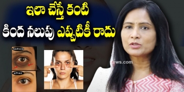 Skin Specialist Dr.D.Sudha Vani about Dark Circles Under Eyes | Home Remedy | Leo Health