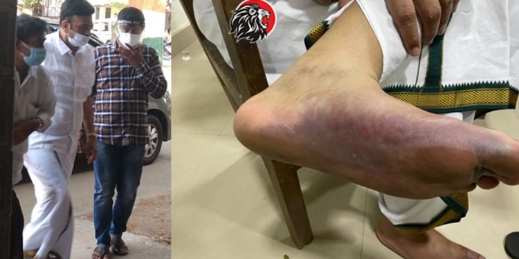 RRR case: Arguments conclude…Final judgment after examination of medical reports