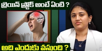 బ్రెయిన్ స్ట్రోక్ అంటే ఏంటి ? | What Is Brain Stroke ? | How To Prevent Brain Stroke | Leo Health