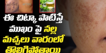 Home Remedy For Dark Spots | How To Get Rid Of Dark Spots Naturally In Telugu | Leo Health