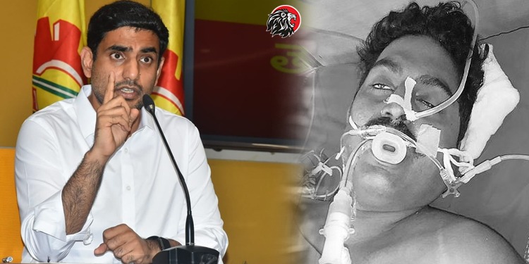 Nara lokesh fires on ycp government